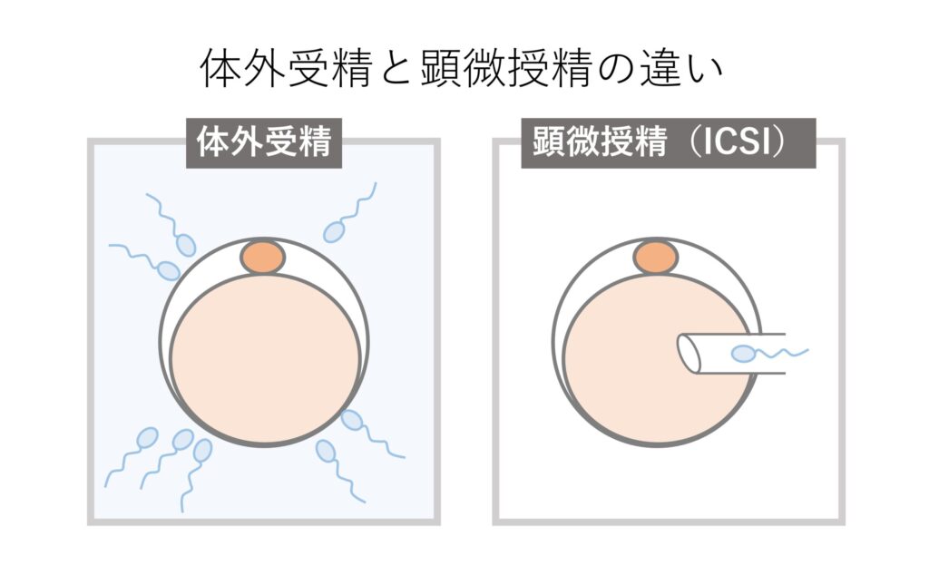 不妊治療について｜治療の種類と進め方を解説